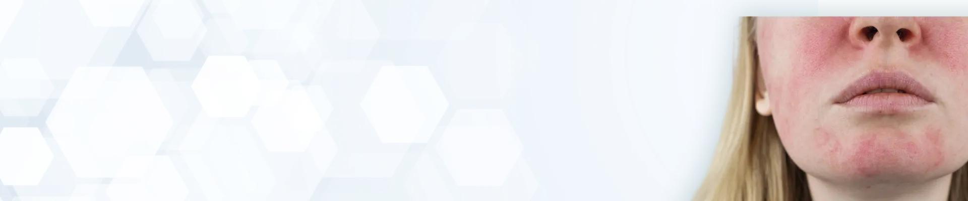 skin_concern_banner