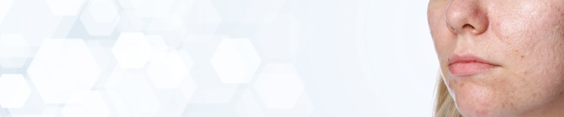 skin_concern_banner_2